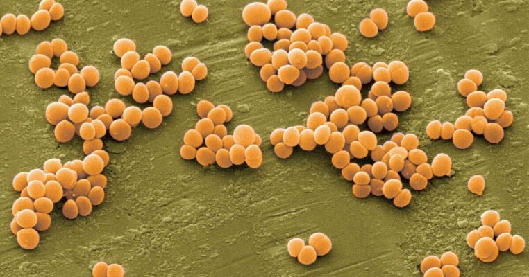Những điều bạn cần biết về vi khuẩn S.Aureus (Vi khuẩn tụ cầu)