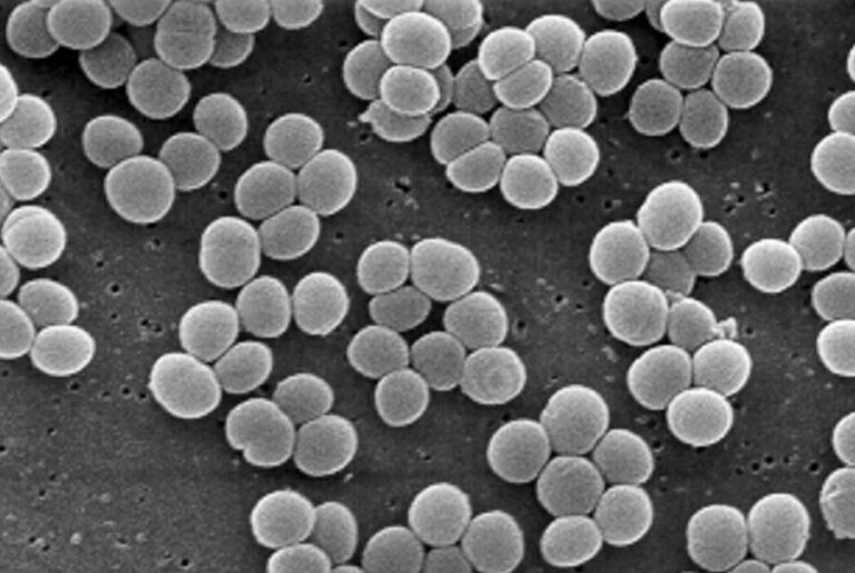 Staphylococcus aureus 3. Непатогенные стафилококки. Сапрофитный стафилококк. Staphylococcus aureus под микроскопом.