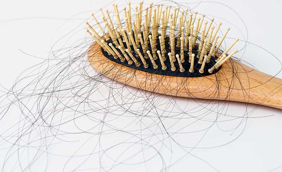 Khi rụng nhiều hơn 100 sợi mỗi ngày được xem là rụng tóc nhiều