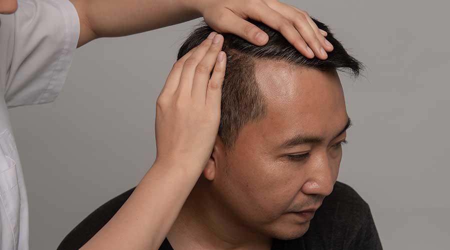 Tùy thuộc vào nguyên nhân gây rụng tóc mà các Bác sĩ sẽ có phương án khắc phục phù hợp