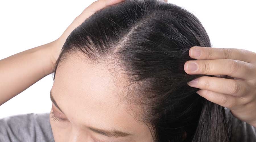 Có nhiều nguyên nhân chủ quan lẫn khách quan dẫn đến việc nang tóc bị tổn thương cần phục hồi
