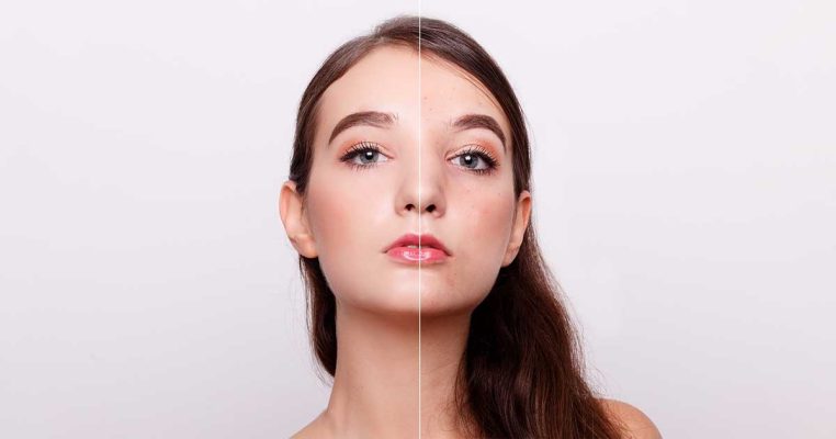 Tái tạo da – Phương pháp làm đẹp cho làn da sáng khỏe
