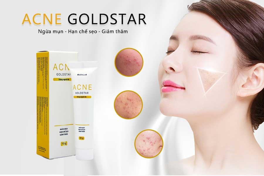 Acne GoldStar là sản phẩm hỗ trợ chăm sóc và xử lý các loại mụn trên da