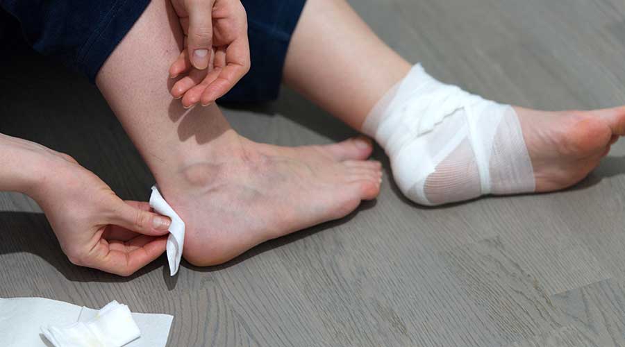 Cố gắng hạn chế cử động nếu vết thương nằm ở những vùng gấp trên cơ thể