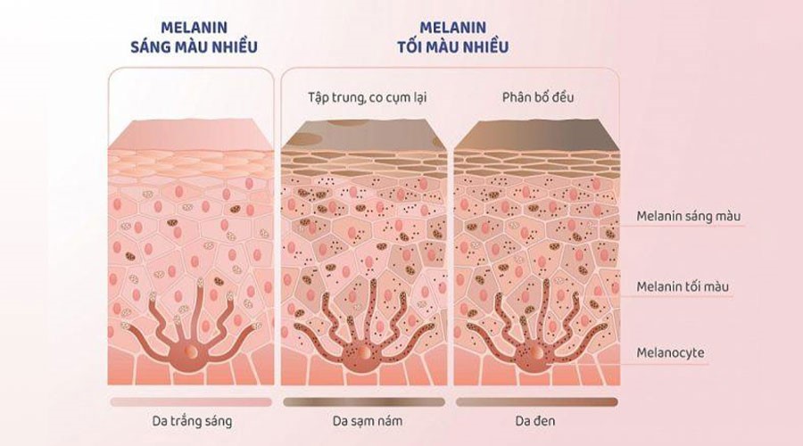 Melanin là yếu tố quyết định màu sắc làn da, tóc hay mắt