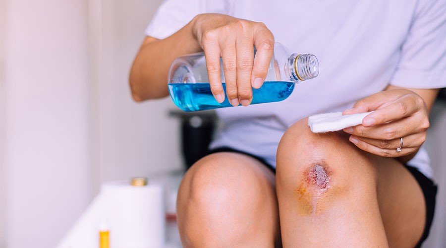 Nếu vết thương nhiễm trùng nhẹ có thể tự sơ cứu và chăm sóc tại nhà