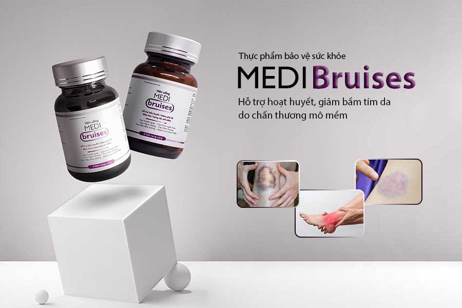 Medi Bruises là viên uống hỗ trợ tiêu huyết, giảm sưng bầm an toàn từ thành phần tự nhiên