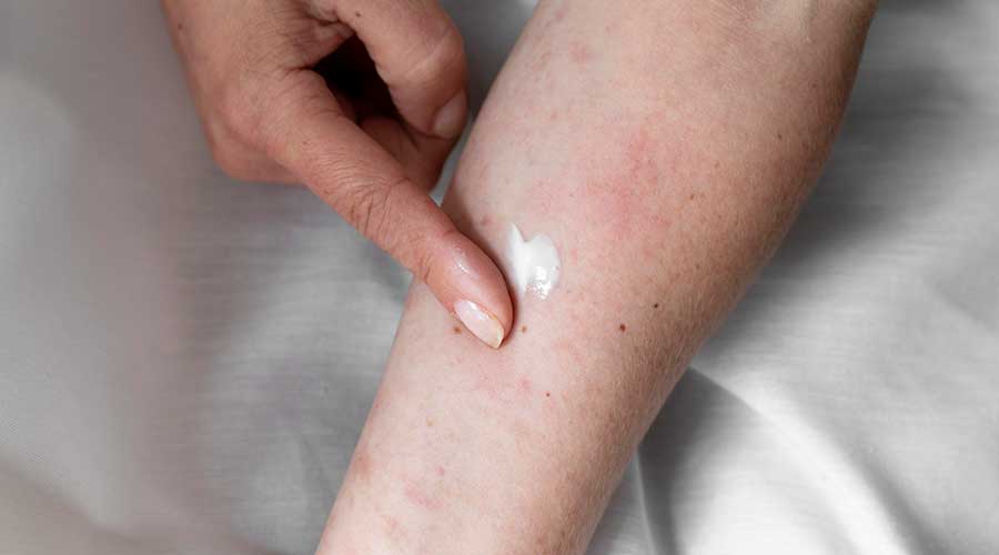 Ngoài ra còn mang nhiều thành phần hoạt chất giúp tiêu sưng, kháng viêm và tái tạo cấu trúc da