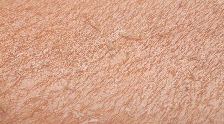 Ngoài ra tình trạng này xuất hiện còn có thể do yếu tố di truyền, thay đổi nội tiết tố, lão hóa,...