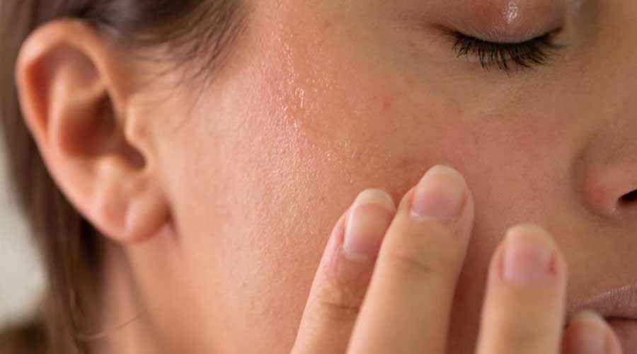 Tình trạng da khô diễn ra ở 3 mức độ: nhẹ, trung bình, nặng với các biểu hiện khác nhau