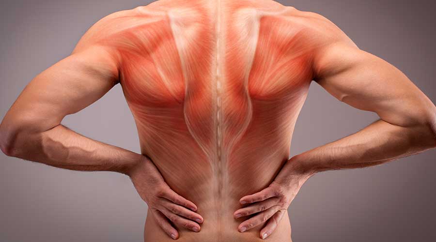 Căng cơ là khi các bó cơ bị co thắt quá mức, dẫn đến cảm giác đau nhức, khó chịu