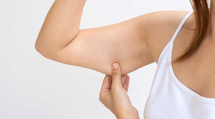 Có thể kiểm tra tình trạng tích mỡ dưới da bằng mắt thường hoặc dùng tay bóp nhẹ