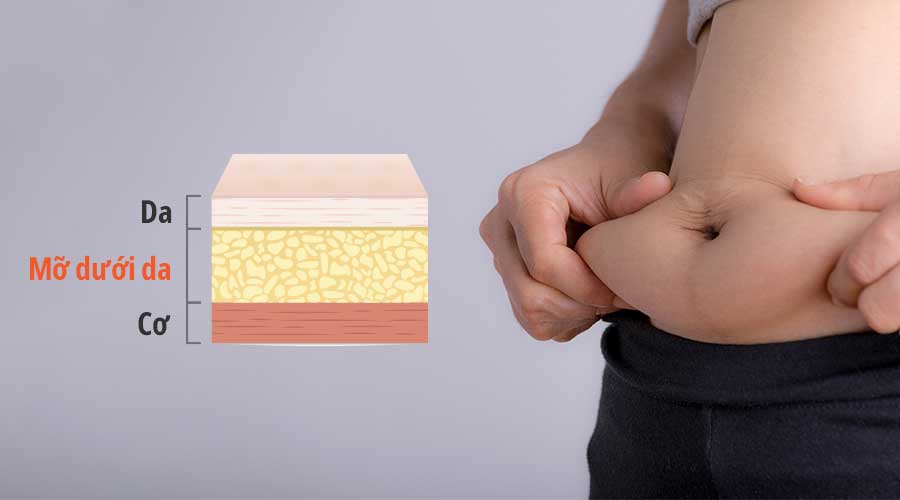 Mỡ dưới da (Subcutaneous Fat) là lớp mỡ nằm ngay bên dưới bề mặt da, giữa da và cơ