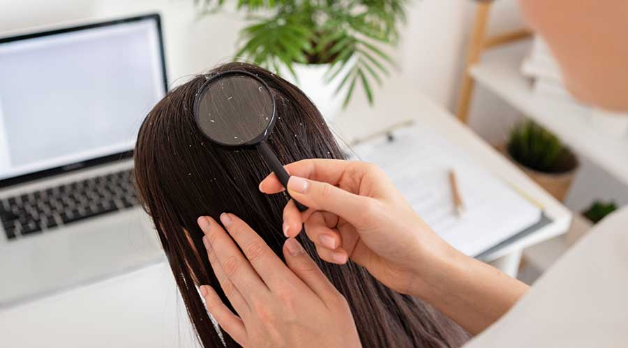 Nếu gàu da đầu nặng kèm theo các triệu chứng như ngứa dữ dội, viêm da, rụng tóc nhiều bất thường bạn nên đến bác sĩ để được thăm khám kịp thời